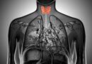 cancer thymus
